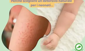 Pelle irritata di un neonato. Scopri come lavare i vestiti dei neonati in lavatrice con detergenti naturali per evitare arrossamenti.